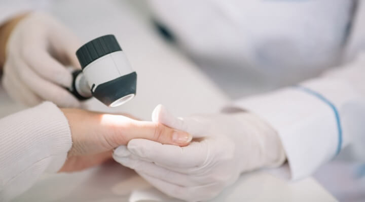dermatologist inspecting hand