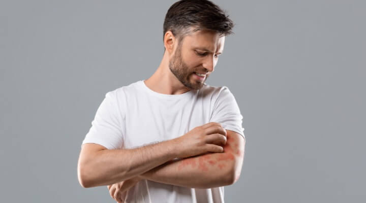 man itching rash