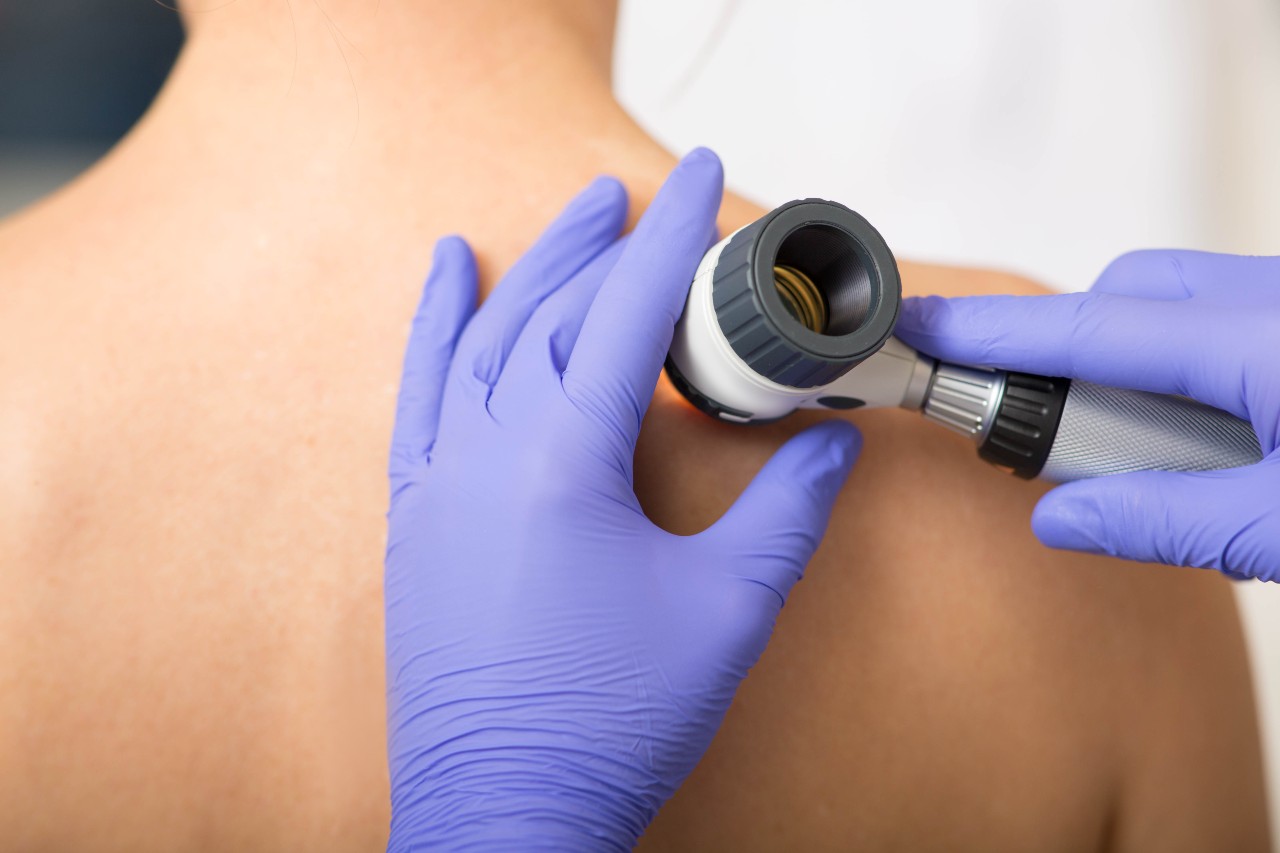 doctor conducts a skin check on patient