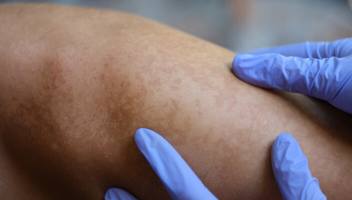 skin being examined