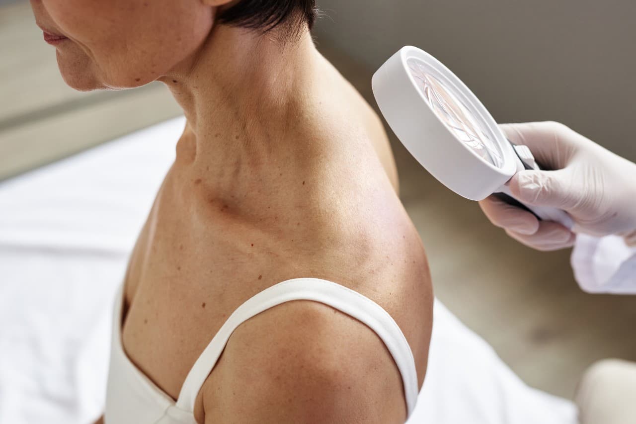 What Happens During a Total Body Skin Exam?