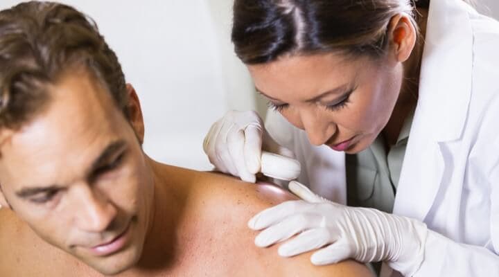 Shielding the Skin: A Comprehensive Guide to Skin Cancer Prevention for Men