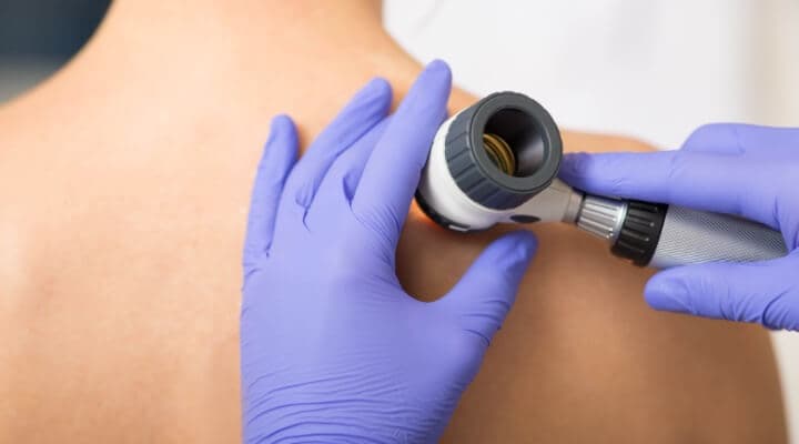 From Head to Toe: Why No Spot Should Be Overlooked in a Total Body Skin Exam