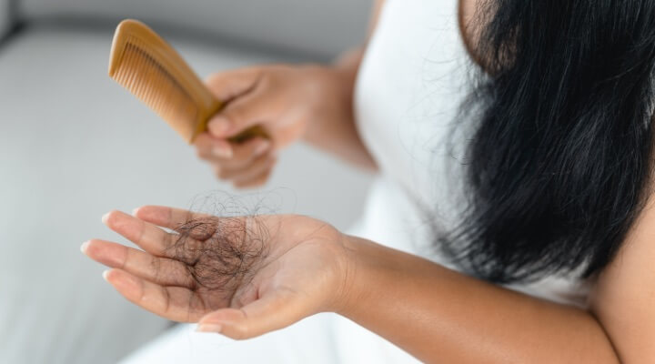 man with hair loss