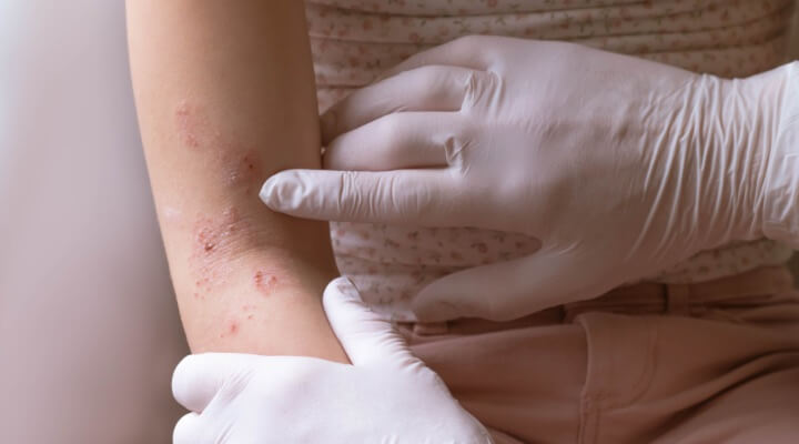dermatologist inspecting skin condition