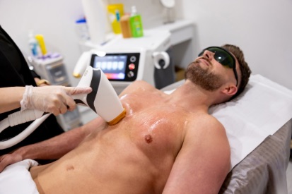 IPL-laser-on-man-chest