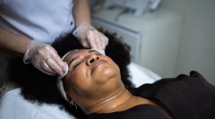 woman getting chemical peel